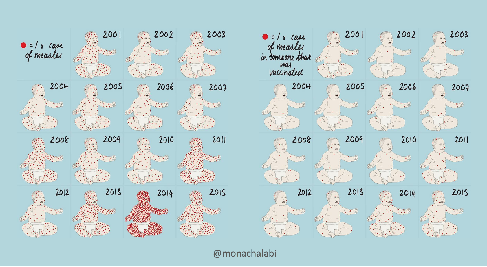Monachalabi_measles Monachalabi_measles
